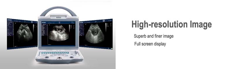 High-resolution images by BW540 digital portable ultrasound scanner